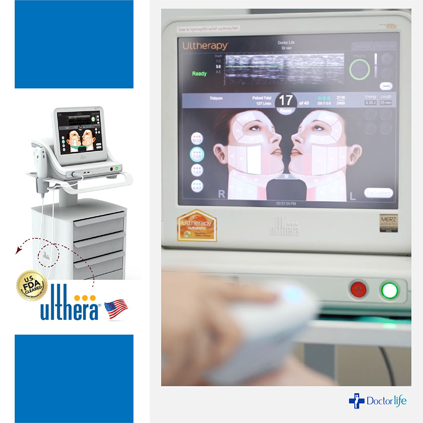 Ulthera