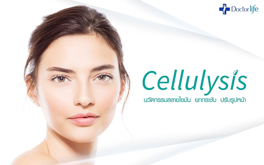 Cellulysis นวัตกรรมสลายไขมัน เพิ่มความกระชับปรับรูปหน้า