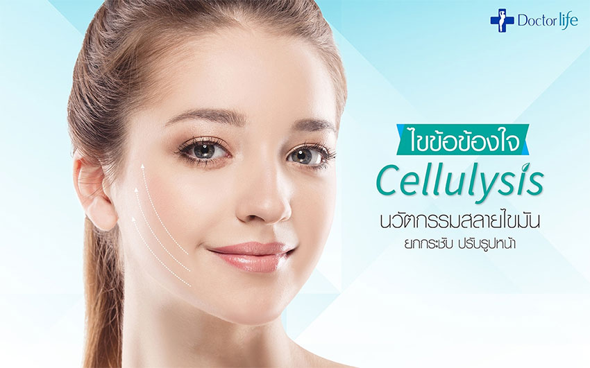 Cellulysis นวัตกรรมสลายไขมัน