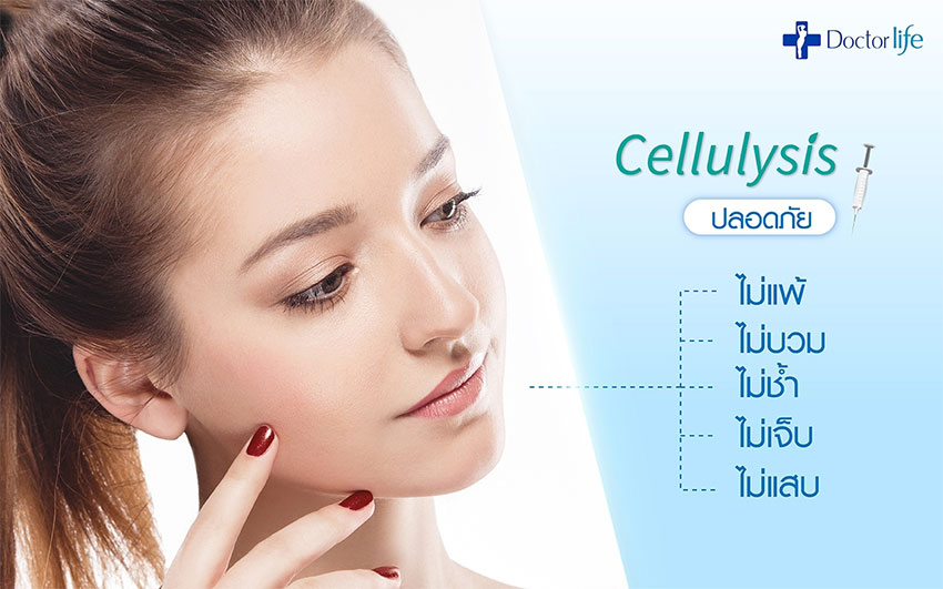 Cellulysis นวัตกรรมสลายไขมัน