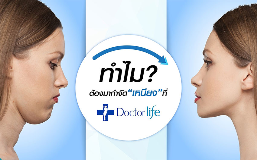 เหนียงหายเพียงสลายไขมันด้วย Cellulysis เพียงแค่ 8,999