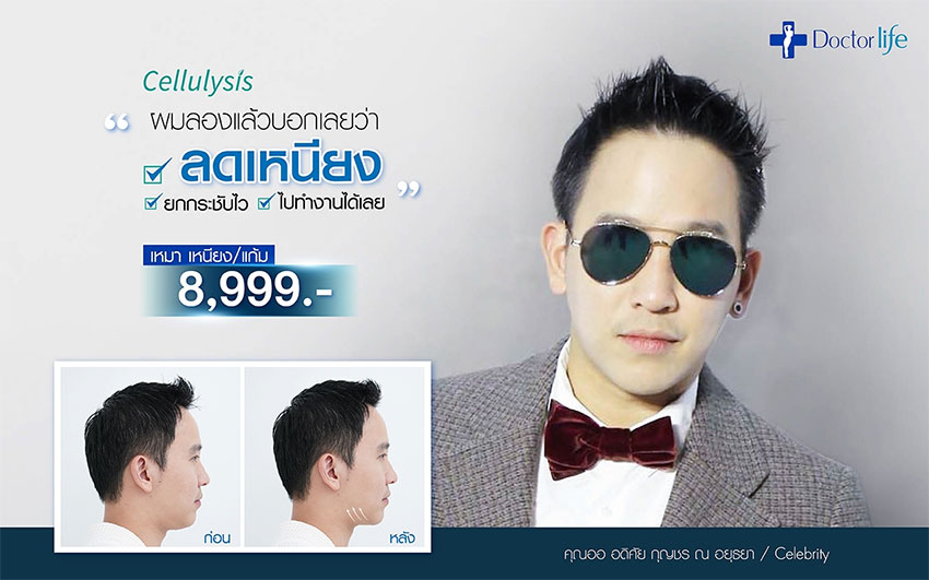 Cellulysis นวัตกรรมสลายไขมัน