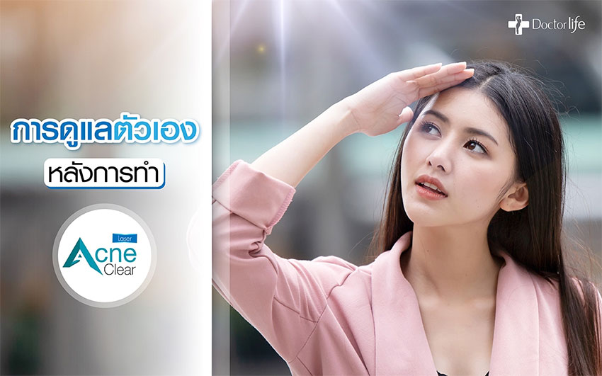Acne Clear Laser เผยผิวใส ไร้รอยสิว