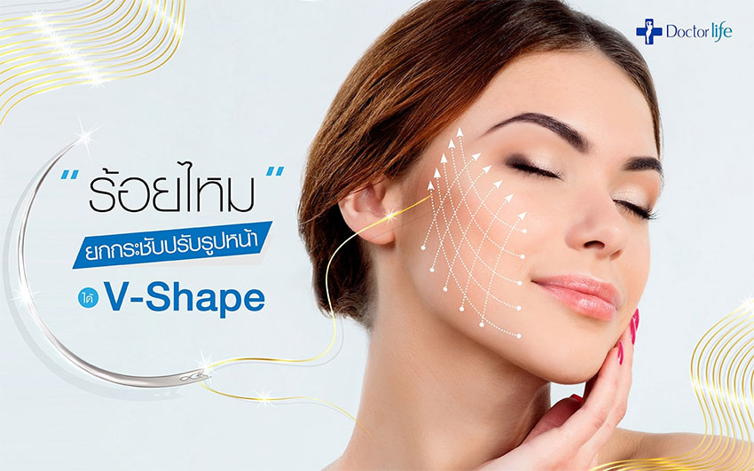 ร้อยไหม ยกกระชับปรับรูปหน้า (Thread Lift)