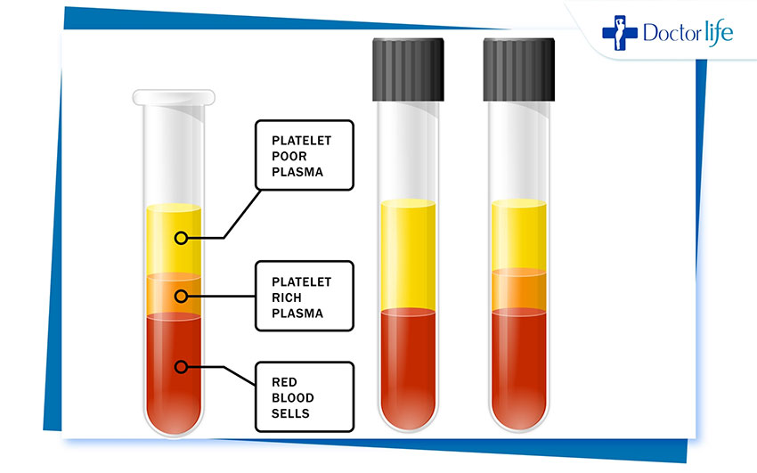 Plasma Rejuvenation Program (PRP) ผิวหน้า