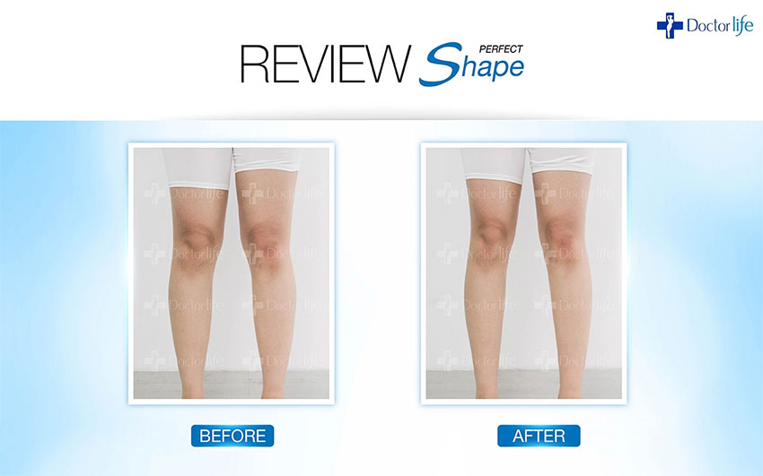 สลายไขมันแบบเร่งด่วน Perfect Shape