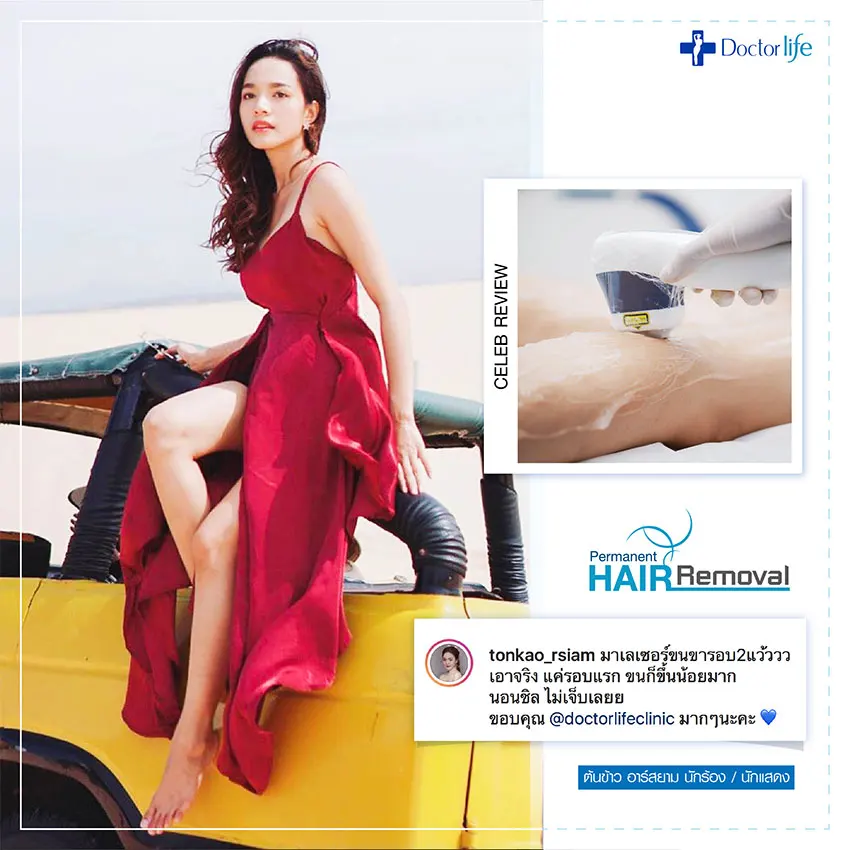 เลเซอร์กำจัดขนถาวร