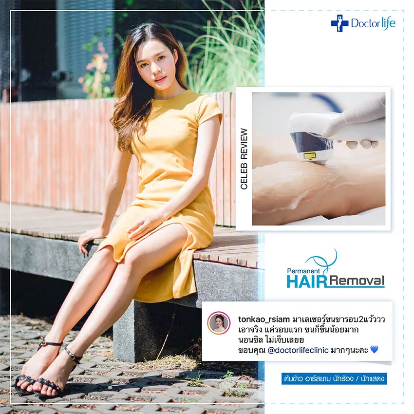 เลเซอร์กำจัดขนถาวร