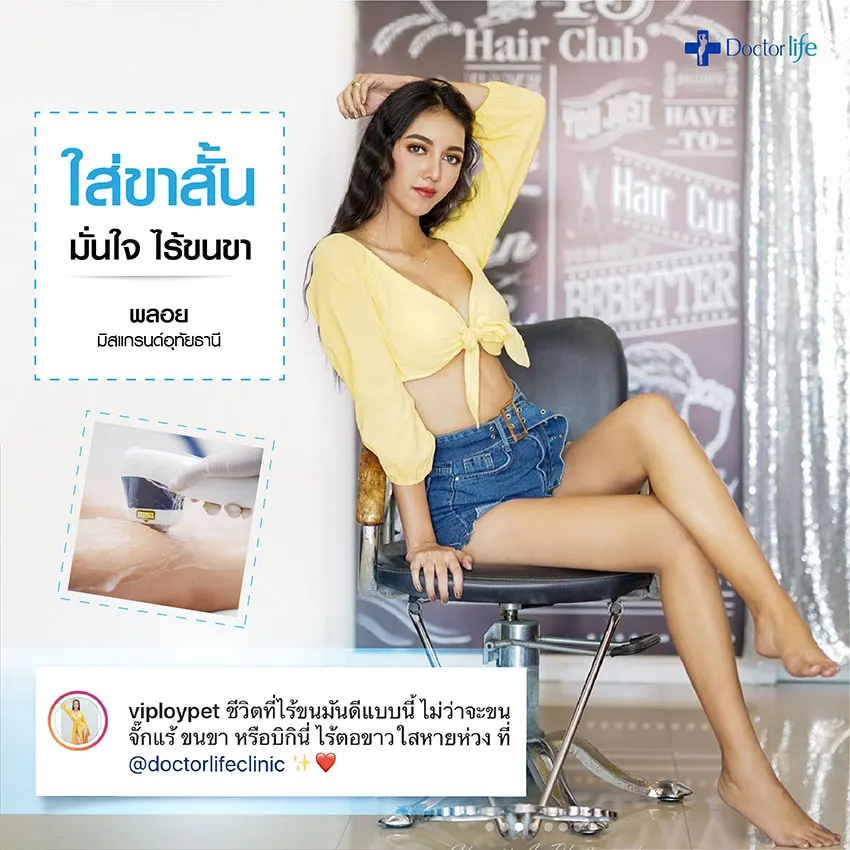 เลเซอร์กำจัดขนถาวร