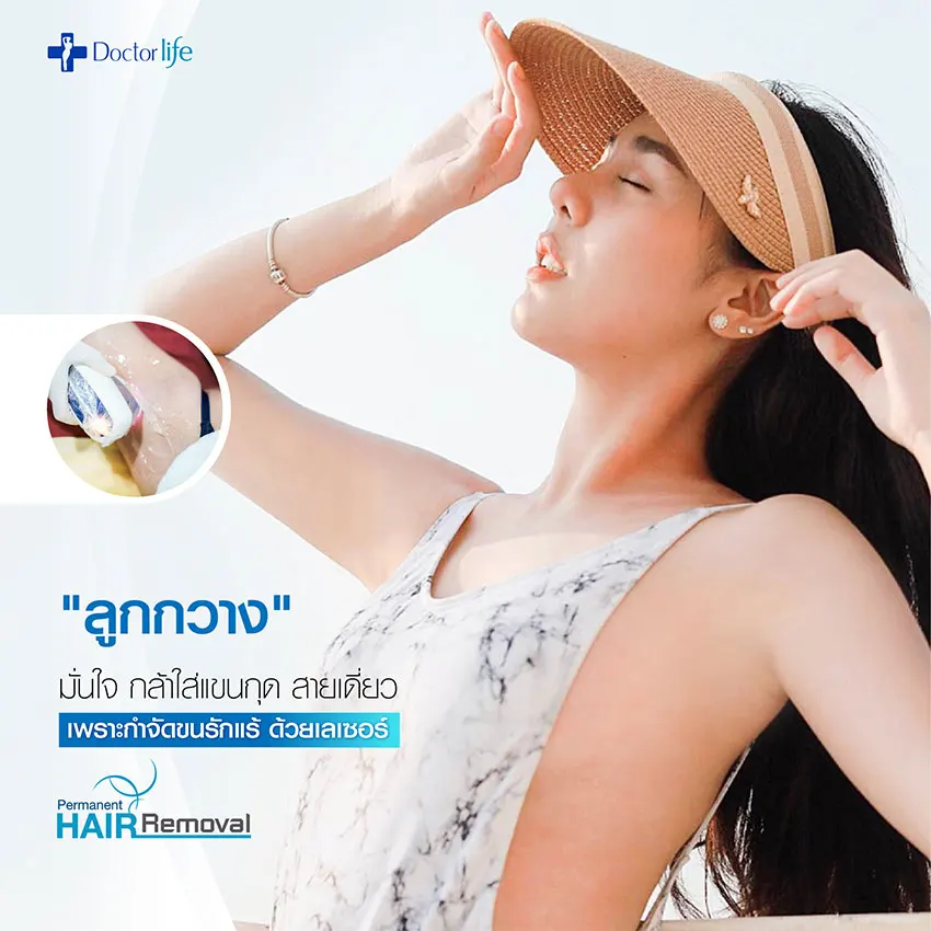 เลเซอร์กำจัดขนถาวร