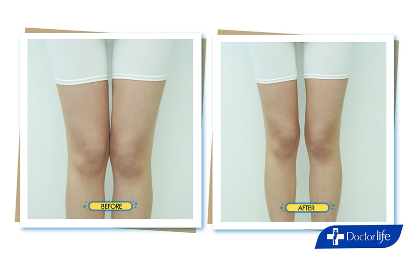 คุณยีนส์ เกวลิน ศรีวรรณา (Perfect Shape)