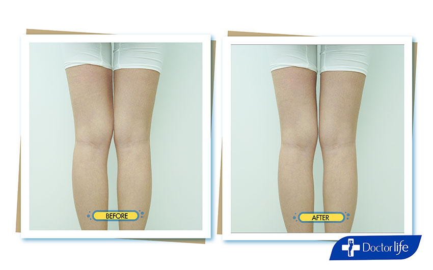 คุณยีนส์ เกวลิน ศรีวรรณา (Perfect Shape)