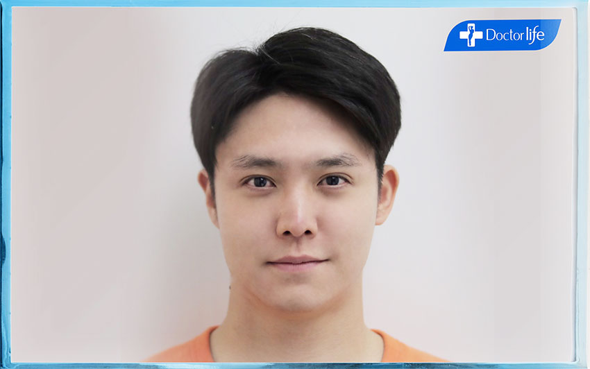 คุณฮิม (จัดการเหนียงที่เห็นผลไวกว่าสูตรอื่นถึง 3 เท่า)