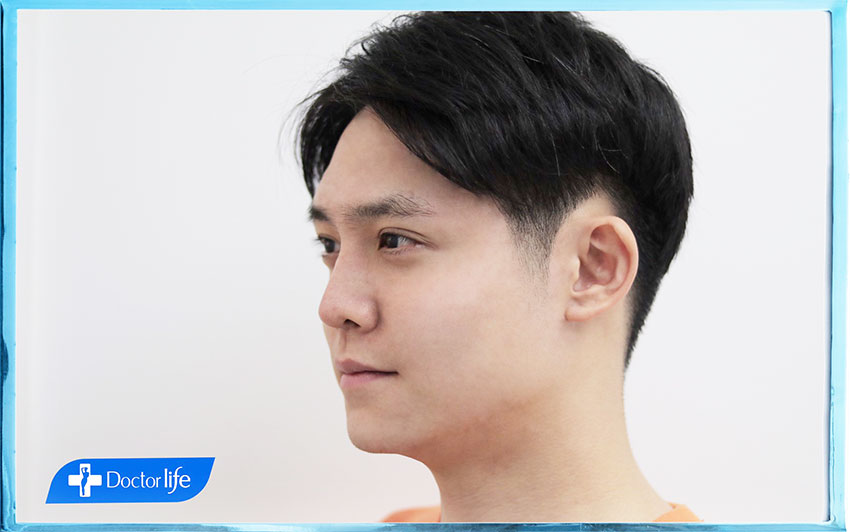 คุณฮิม (จัดการเหนียงที่เห็นผลไวกว่าสูตรอื่นถึง 3 เท่า)