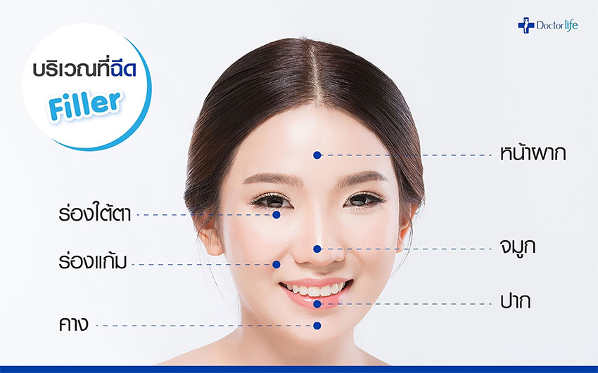 ฟิลเลอร์ (Filler)