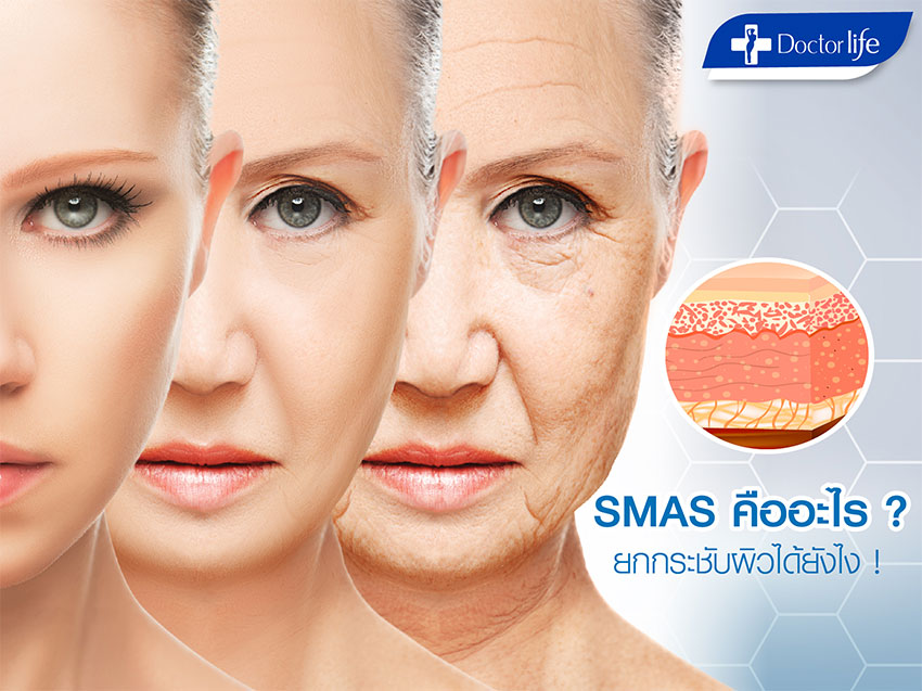 SMAS คืออะไร ยกกระชับผิวได้อย่างไร (ULTHERA)