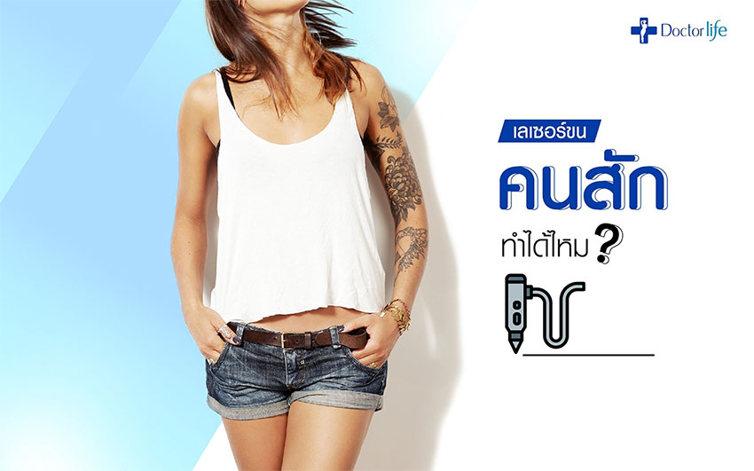 เลเซอร์ขนคนสักทำได้ไหม