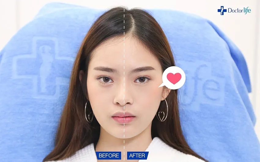 สารเติมเต็ม เติมเต็มร่องลึกเพิ่มความสดใสไม่กลับมาโทรม