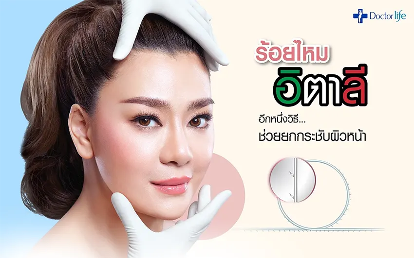 ร้อยไหมอิตาลี อีกหนึ่งวิธีที่ช่วยยกกระชับใบหน้า