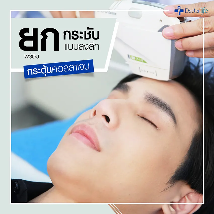 HIFU ยกกระชับผิว