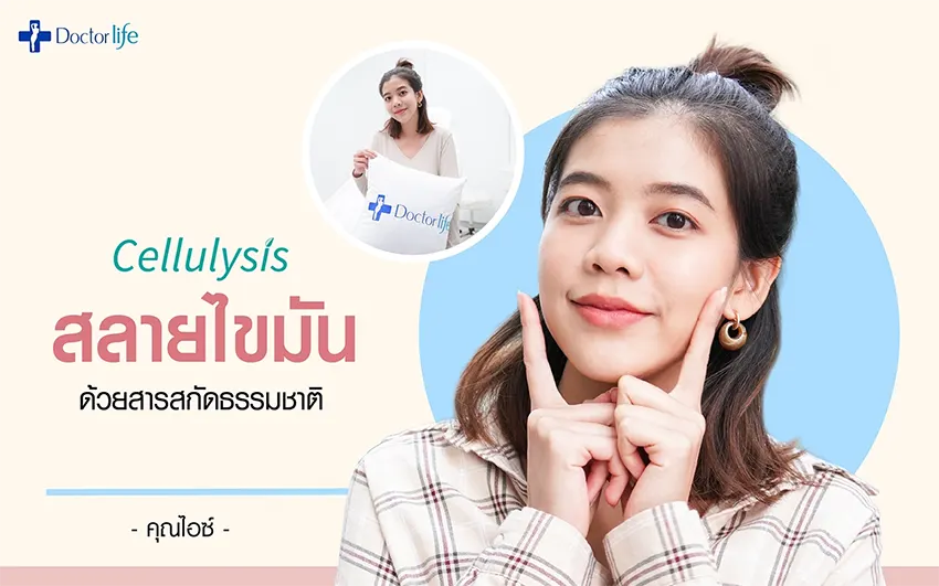 Cellulysis สลายไขมันด้วยสารสกัดธรรมชาติ คุณไอซ์