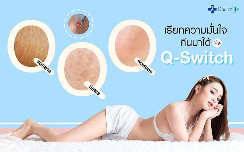 เลเซอร์ Q-Switch ลบผิวหมองคล้ำลดแผลแตกลายเรียกความมั่นใจกลับคืน