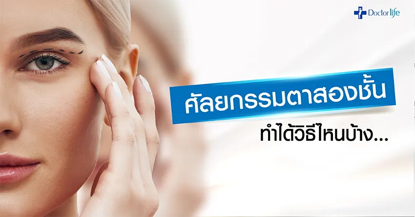 ทำตาสองชั้น ศัลยกรรมตาสองชั้น