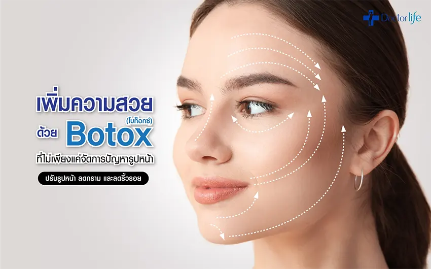 Botox (โบท็อกซ์)