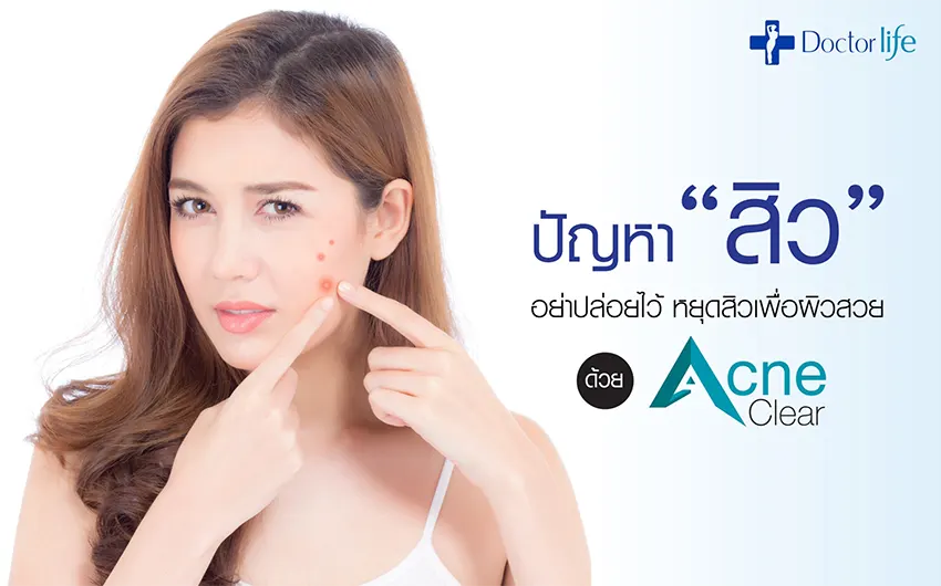 หยุดปัญหาสิวเพื่อผิวสวยด้วย Acne Clear Laser