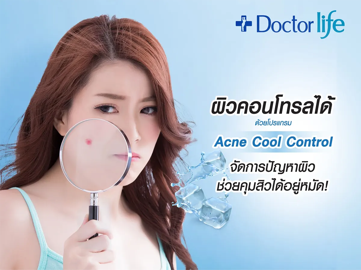 Acne Cool Control จัดการปัญหาผิว ช่วยคุมสิวได้อยู่หมัด
