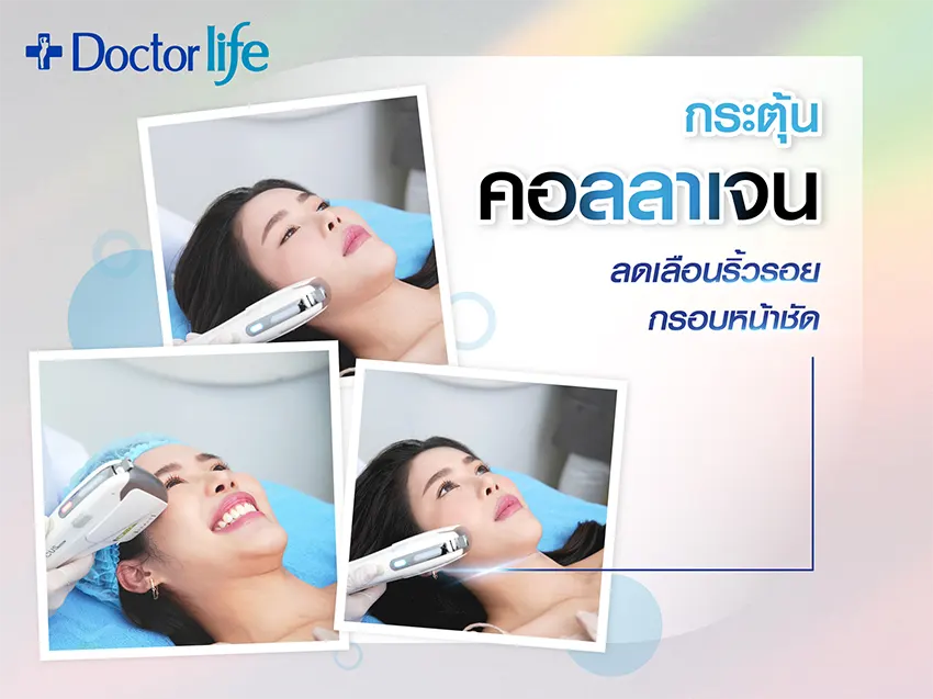 ยกกระชับ Fractional HIFU Duo Lift