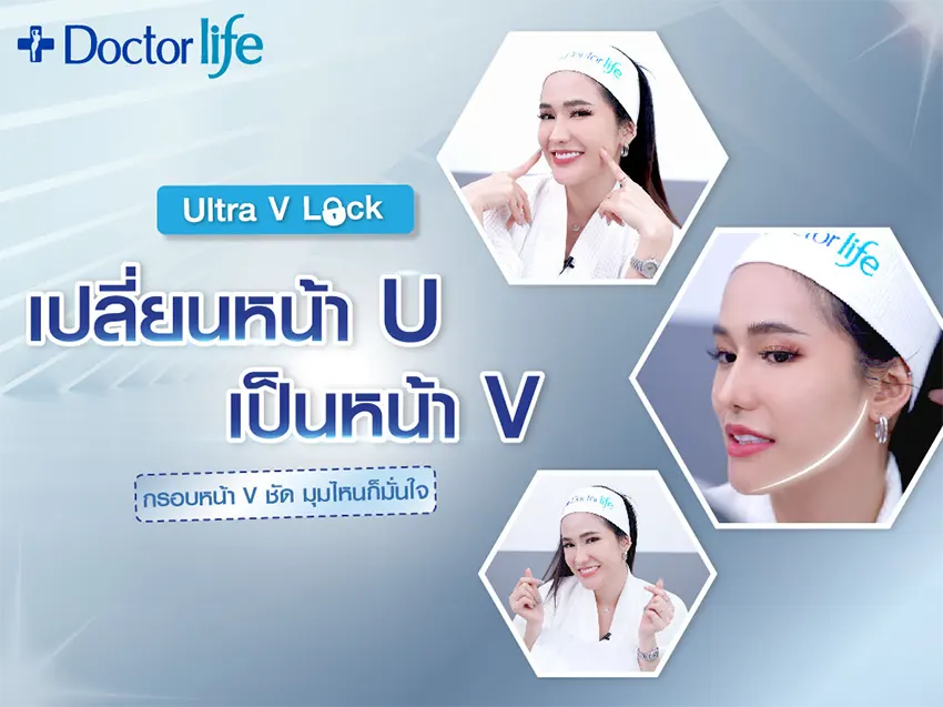 Ultra V Lock เปลี่ยนหน้า U เป็นหน้า V ยกกระชับกรอบหน้าชัด