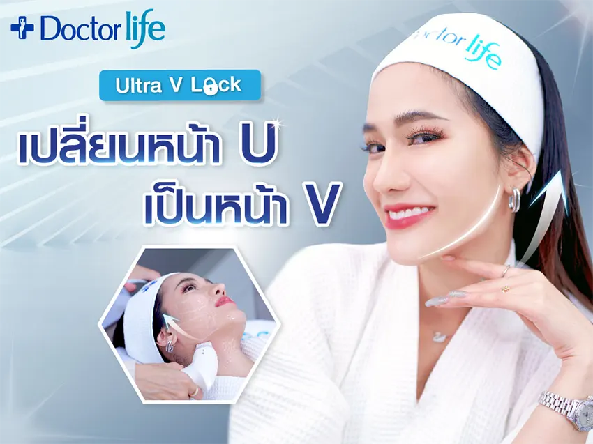 Ultra V Lock