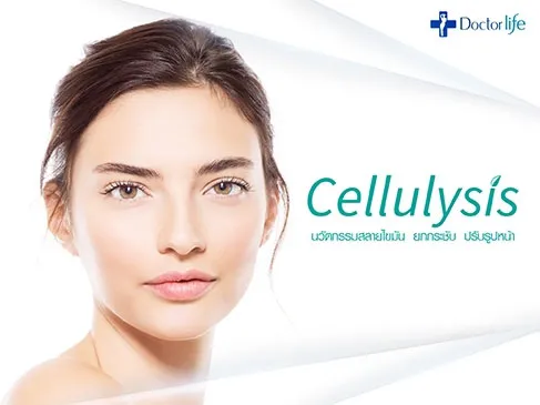 Cellulysis นวัตกรรมสลายไขมัน เพิ่มความกระชับปรับรูปหน้า