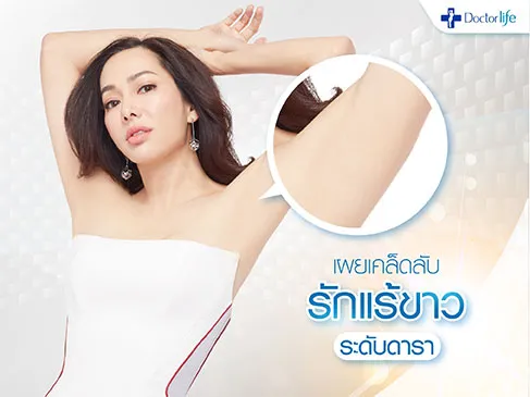 รักแร้ขาวเนียนอย่างดารา ใต้วงแขนมีออร่าได้จริง โดยเลเซอร์รักแร้ Under Arm Ultimate White (Q-Uarm) 