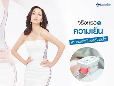 ความเย็นสามารถกำจัดเซลล์ไขมันให้ตายได้จริงหรือ?