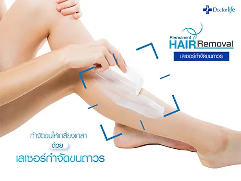 กำจัดขนให้เกลี้ยงเกลาด้วยเลเซอร์กำจัดขนถาวร (Permanent Laser Hair Removal)