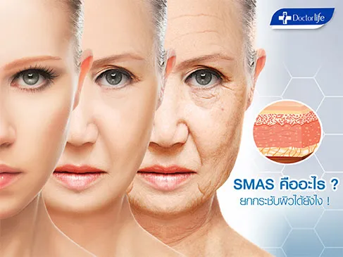 SMAS คืออะไร ยกกระชับผิวได้อย่างไร (ULTHERA)