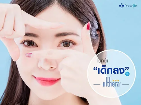ใบหน้าเด็กลงด้วย Ulthera