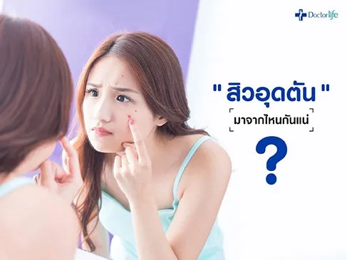 สิวอุดตัน มาจากไหนกันแน่
