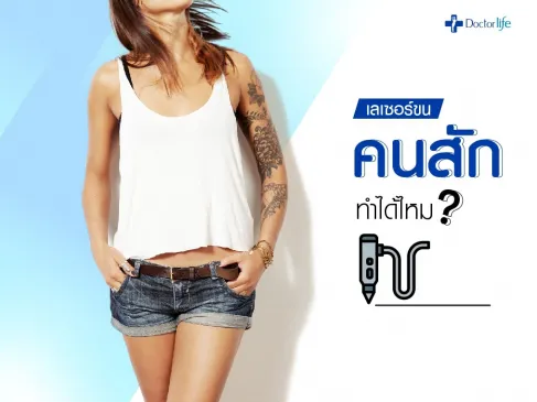 เลเซอร์ขนคนสักทำได้ไหม
