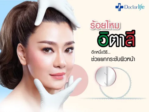 ร้อยไหมอิตาลี อีกหนึ่งวิธีที่ช่วยยกกระชับใบหน้า