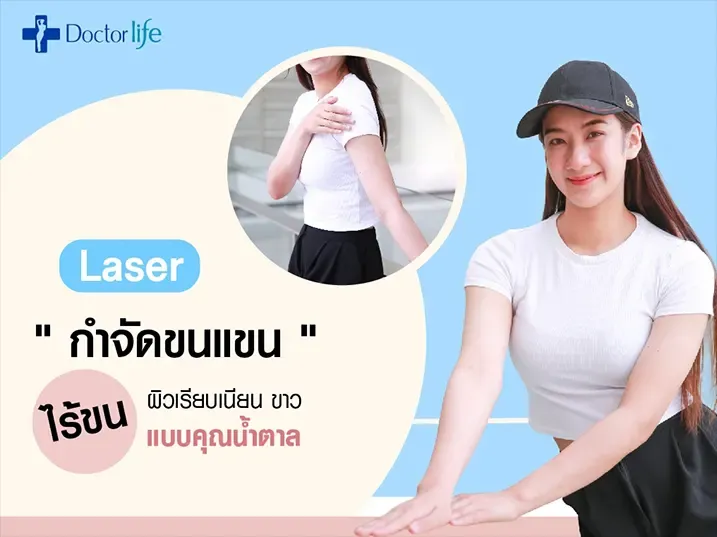 Laser กำจัดขนแขน ผิวเรียบเนียน ขาว ไร้ขน แบบคุณน้ำตาล