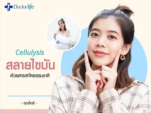 Cellulysis สลายไขมันด้วยสารสกัดธรรมชาติ คุณไอซ์