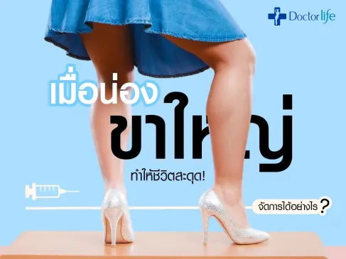 เมื่อน่องขาใหญ่ทำให้ชีวิตสะดุดจัดการได้อย่างไร