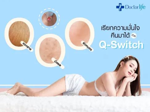เลเซอร์ Q-Switch ลบผิวหมองคล้ำลดแผลแตกลายเรียกความมั่นใจกลับคืน