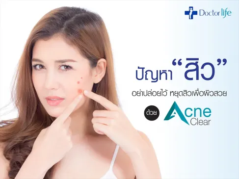 หยุดปัญหาสิวเพื่อผิวสวยด้วย Acne Clear Laser