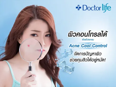 Acne Cool Control จัดการปัญหาผิว ช่วยคุมสิวได้อยู่หมัด